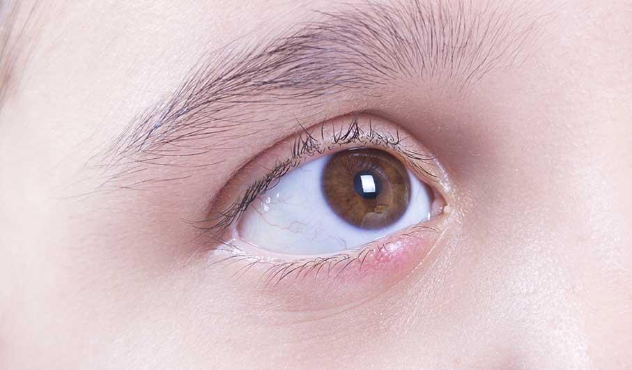 Ayurvedic Remedies for Puffy Eyes– Uma Oils